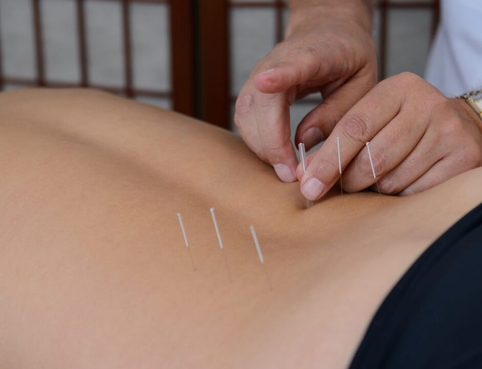acupunctuur voor prostatitis