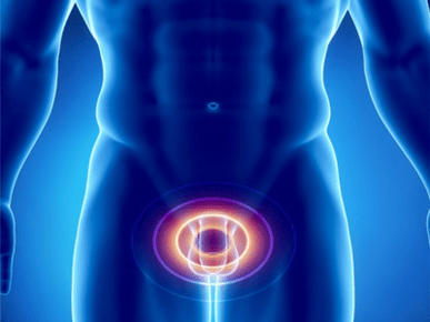 Prostatitis – ontsteking van de prostaatklier bij een man