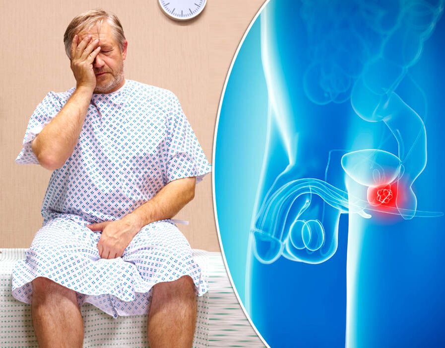 Bij een man met prostatitis wordt een ziekte vastgesteld